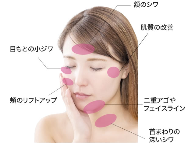 HICSU ハイックスリフトアップ業務用美容機器たるみしわVmax