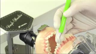 ニッシン 歯科模型 顎模型 歯科衛生士 NISSIN デンタルモデル SRP実習