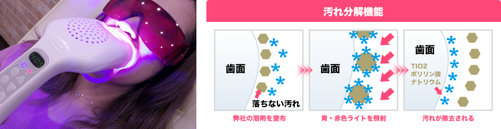 KOBEホワイトニングのセルフホワイトニング┃KOBEホワイトニング株式会社